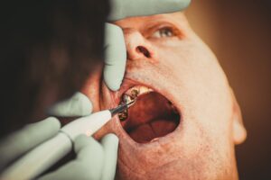 Dental patient receiving a gentle implant healing check while seated in a dental treatment room.