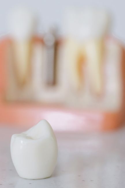 Adult patient reviewing dental implant scans with a clinician in a bright examination room.