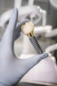 Dental professional reviewing a 3D jaw scan beside a model showing bone loss and an implant site.